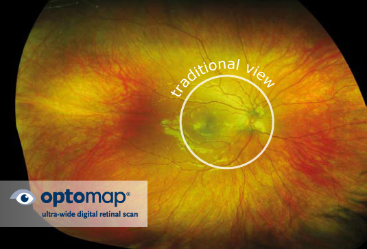 Retina Imaging  Village Optical